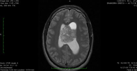 Screen shot 2014-09-30 at 8.09.14 PM